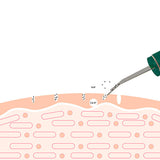 Shoveling Machine Exfoliating Skin Care